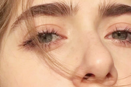 双眼皮修复的原理