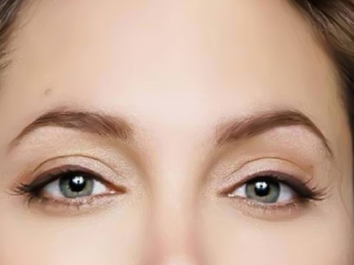 无痕开眼角去哪里 无痕开眼角去哪里