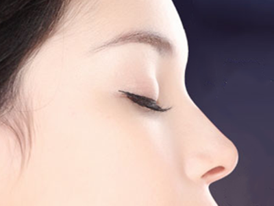 鼻子假体取出的副作用 鼻子假体取出的副作用