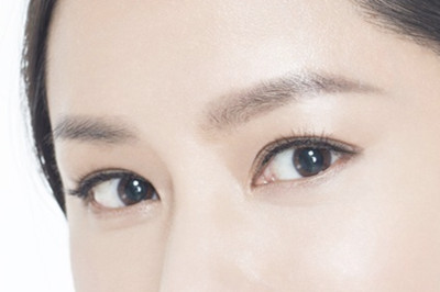 开眼角后恢复需要多久 开眼角后恢复需要多久