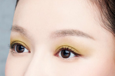 开眼角后恢复需要多久 开眼角后恢复需要多久