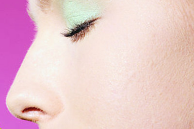 鼻子假体取出影响美观吗 鼻子假体取出影响美观吗