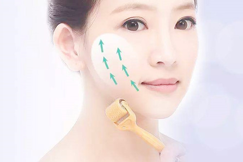 做完微针几天后效果最佳 做完微针几天后效果最佳